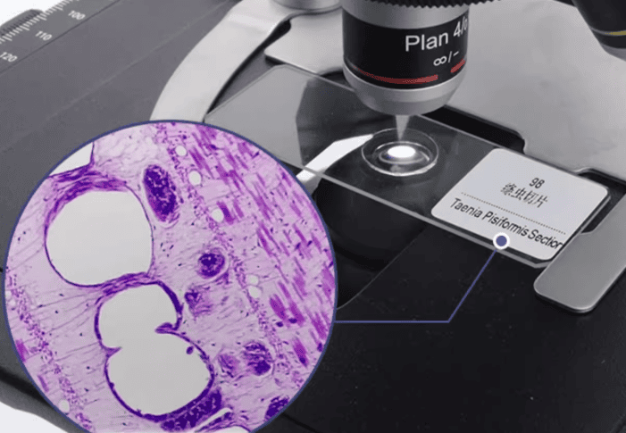 biological tissue